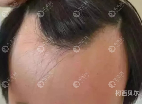 女人毛毛扒开自慰女人毛毛扒开自慰，揭秘背后的心理与文化现象